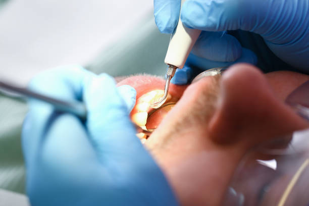 Best Emergency Tooth Extraction  in Arche, OK